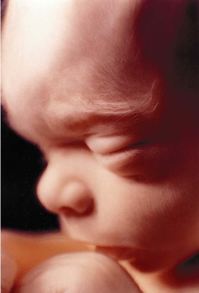 unborn baby portrayal